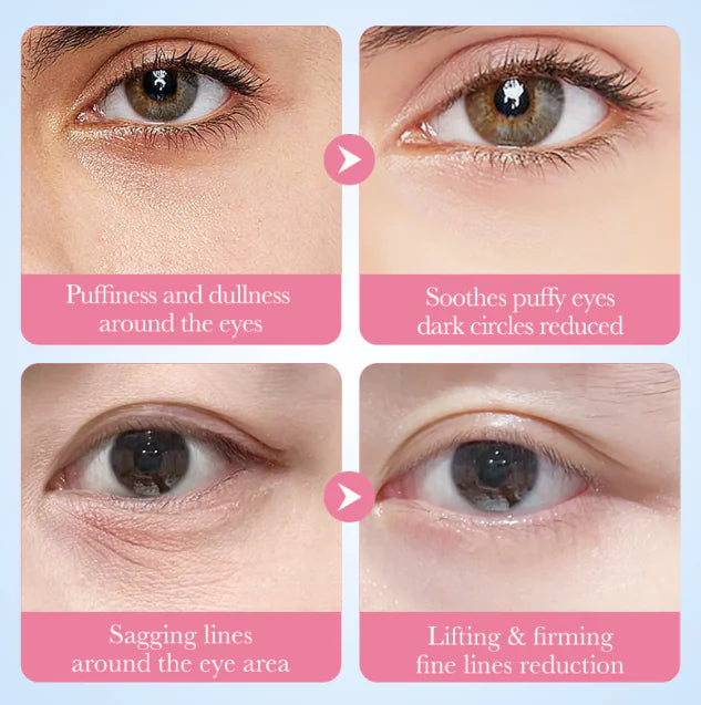 Collagen Eye Mask - Hydrating Under-Eye Patches for Puffiness and Dark Circles (80g)