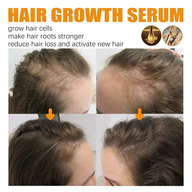Biotin Hair Growth Spray - Strengthening Formula with Castor Oil, Ginseng & Ginger Root Extract (30ml)