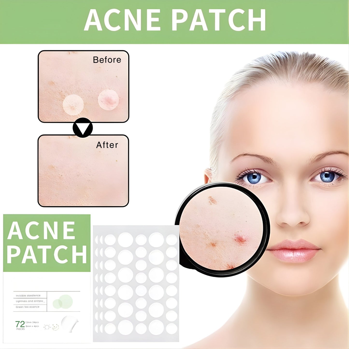 Anti-Acne Concealer Patch - Invisible Blemish Protection (72 Patches)