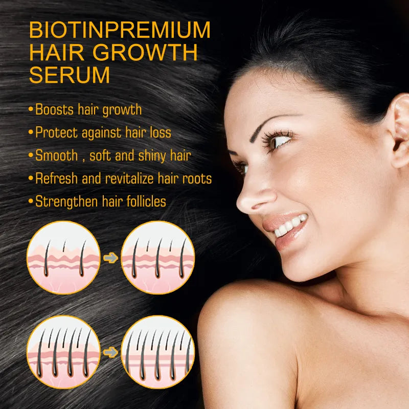 Biotin Hair Growth Spray - Strengthening Formula with Castor Oil, Ginseng & Ginger Root Extract (30ml)